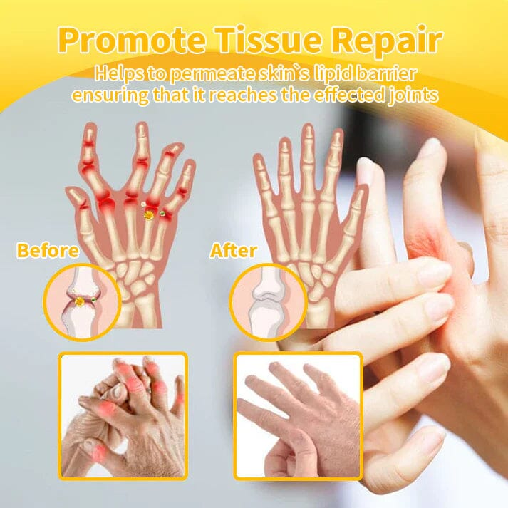 Flysmusยฎ Bee Venom Pain-Relief Bone Healing Cream๐๐