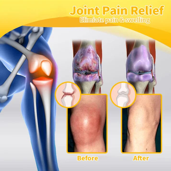 Flysmusยฎ Bee Venom Pain-Relief Bone Healing Cream๐๐